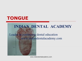 TONGUE
INDIAN DENTAL ACADEMY
Leader in continuing dental education
www.indiandentalacademy.com

www.indiandentalacademy.com

 