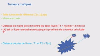 cancers-du-sein-nouvelle-classification-tnm-8-dition-ajcc-pdf