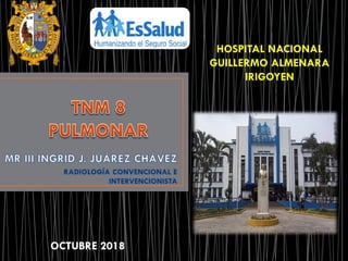 HOSPITAL NACIONAL
GUILLERMO ALMENARA
IRIGOYEN
OCTUBRE 2018
 