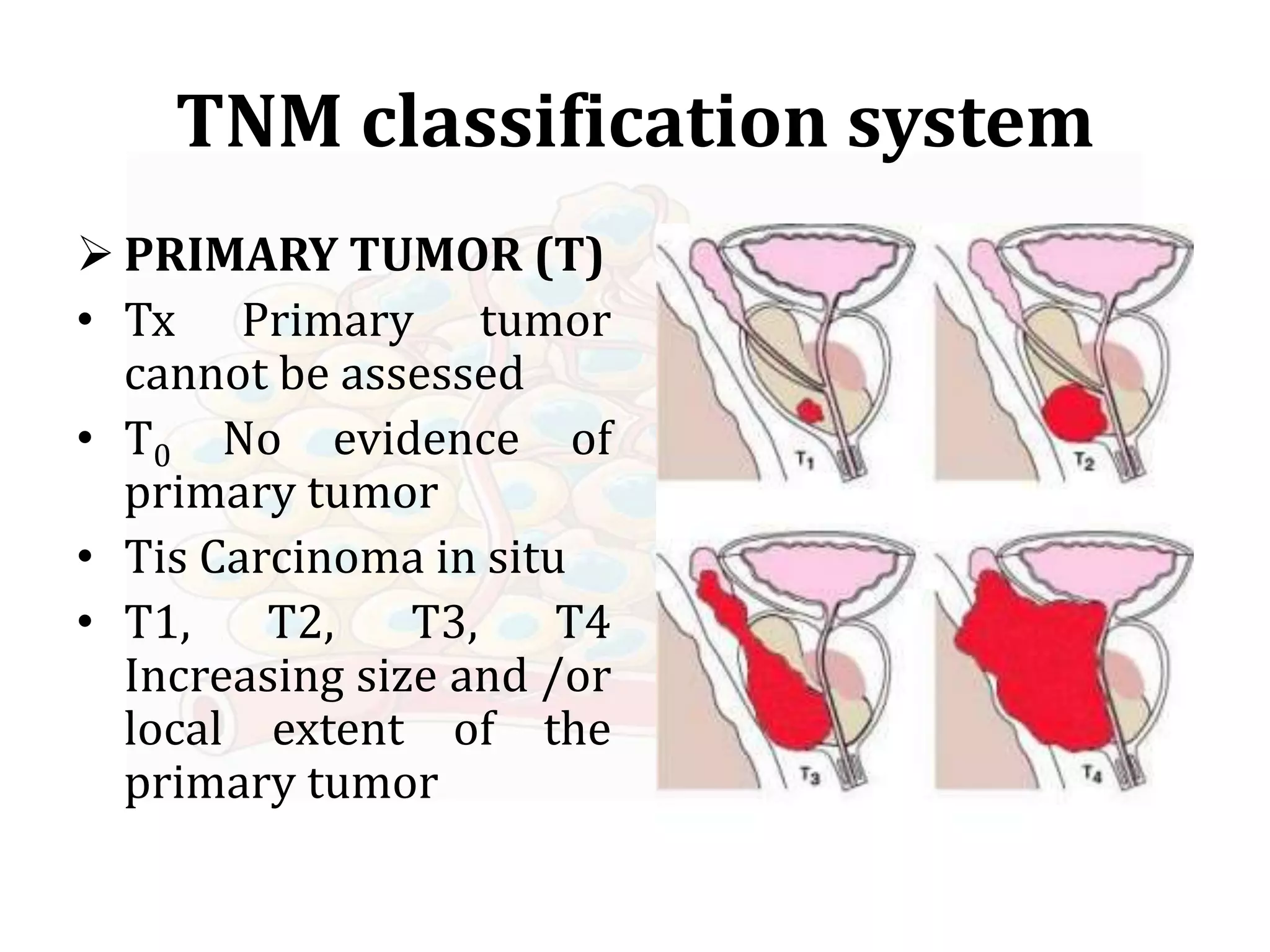 TNM Staging of tumor | PPTX