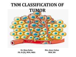 TNM CLASSIFICATION OF
TUMOR
Dr. Binu Babu
Ph. D (N), MSN, MBA
Mrs. Jincy Ealias
MSN, RN
 