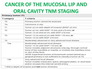CANCER OF THE MUCOSAL LIP AND
ORAL CAVITY TNM STAGING
 