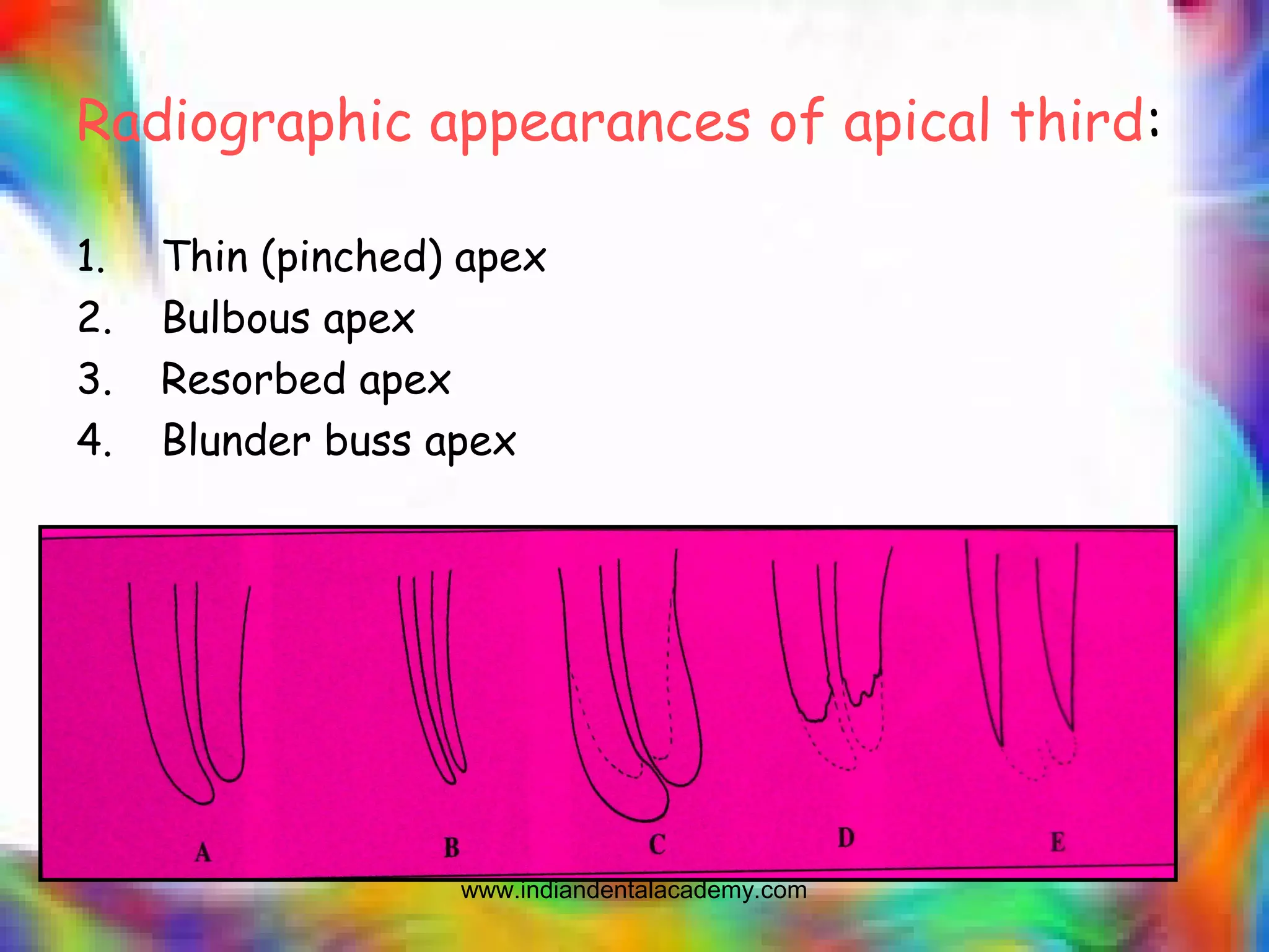 Radiographic appearances of apical third:
1. Thin (pinched) apex
2. Bulbous apex
3. Resorbed apex
4. Blunder buss apex
www.indiandentalacademy.com
 