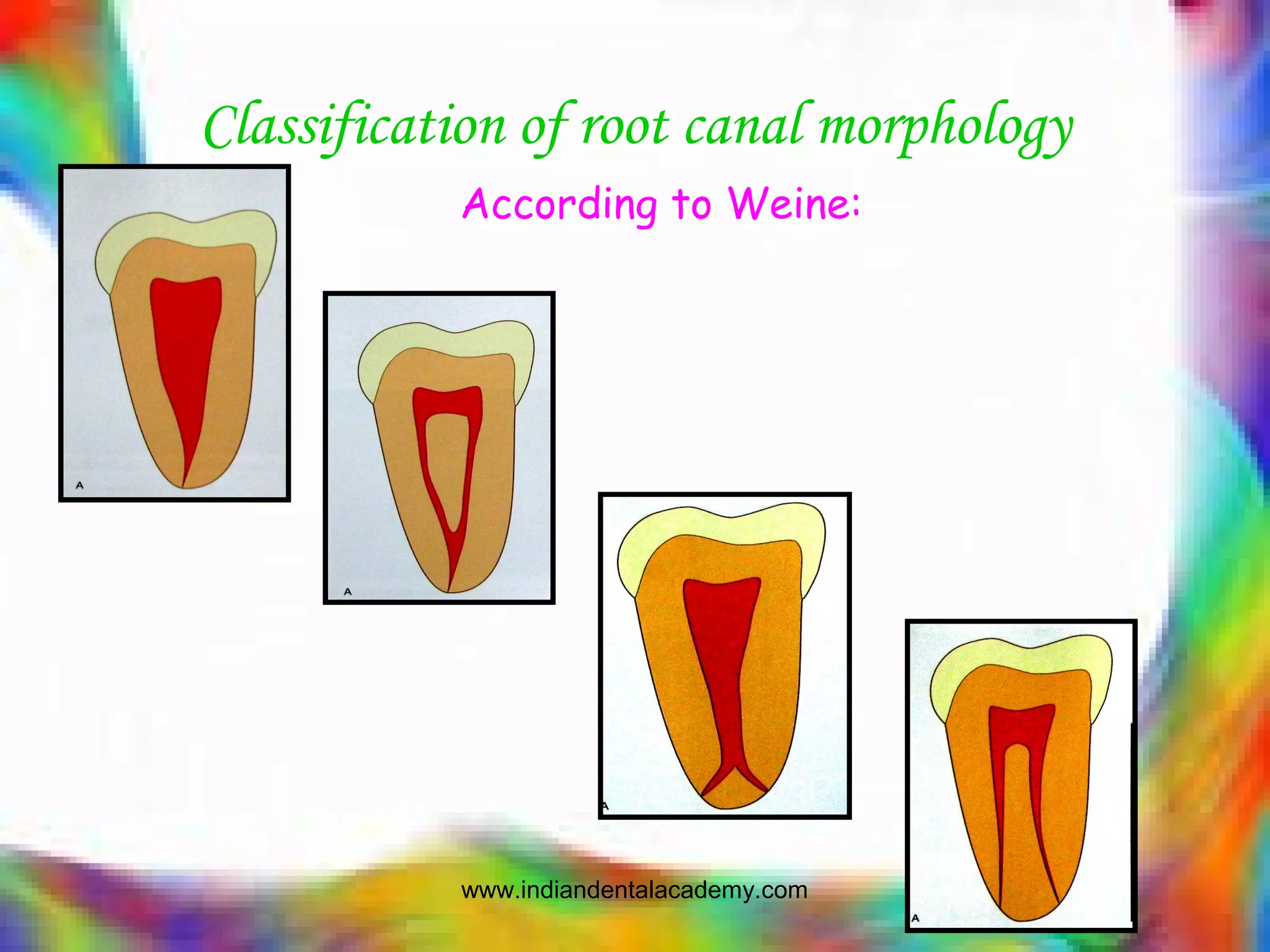 Classification of root canal morphology
According to Weine:
www.indiandentalacademy.com
 