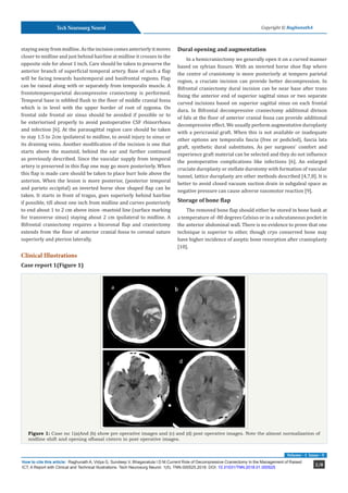 Current Role of Decompressive Craniectomy In the Management of Raised ...