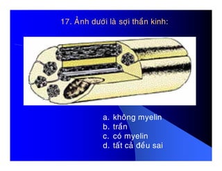 17. AÛnh döôùi laø sôïi thaàn kinh:
a. khoâng myelin
b. traàn
c. coù myelin
d. taát caû ñeàu sai
 