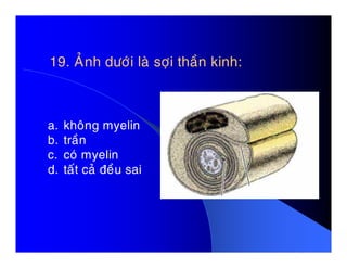 a. khoâng myelin
b. traàn
19. AÛnh döôùi laø sôïi thaàn kinh:
b. traàn
c. coù myelin
d. taát caû ñeàu sai
 
