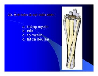 20. AÛnh beân laø sôïi thaàn kinh:
a. khoâng myelin
b. traàn
c. coù myelin
d. taát caû ñeàu said. taát caû ñeàu sai
 
