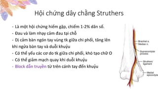 Hội chứng dây chằng Struthers
- Là một hội chứng hiếm gặp, chiếm 1-2% dân số.
- Đau và làm nhạy cảm đau tại chỗ
- Dị cảm bàn ngón tay vùng tk giữa chi phối, tăng lên
khi ngửa bàn tay và duỗi khuỷu
- Có thể yếu các cơ do tk giữa chi phối, khó tạo chữ O
- Có thể giảm mạch quay khi duỗi khuỷu
- Block dẫn truyền từ trên cánh tay đến khuỷu
 