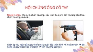 HỘI CHỨNG ỐNG CỔ TAY
Nguyên nhân: chèn ép, chấn thương, cấu trúc, béo phì, bất thường cấu trúc,
chấn thương, mổ cũ,…
Chèn ép lâu ngày dần gây thiếu máu nuôi dây thần kinh  huỷ myelin  đủ
nặng sẽ gây thoái hoá wallerin  tổn thương sợi trục
 