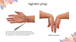 Nghiệm pháp
Phalen’s maneuver
 
