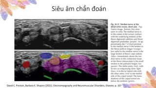 Siêu âm chẩn đoán
David C. Preston, Barbara E. Shapiro (2021). Electromyography and Neuromuscular Disorders, Elsevier, p. 337
 