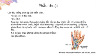 Phẫu thuật
Cắt dây chằng chèn ép dây thần kinh.
Nội soi: ít đau hơn.
Mổ hở.
Sau một thời gian, 2 đầu dây chằng dần nối lại, tuy nhiên vẫn có khoảng trống
nhiều hơn so với trước. Bệnh nhân nên được khuyến khích vận động tay lại sau
phẫu thuật, từng bước một, tránh các chuyển động tay mạnh mẽ, nhất là vị trí cổ
tay.
Có thể các triệu chứng không hoàn toàn mất đi
sau phẫu thuật.
 