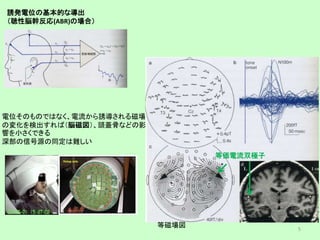 誘発電位の基本的な導出
（聴性脳幹反応(ABR)の場合）
電位そのものではなく、電流から誘導される磁場
の変化を検出すれば（脳磁図）、頭蓋骨などの影
響を小さくできる
深部の信号源の同定は難しい
等磁場図
等価電流双極子
5
 