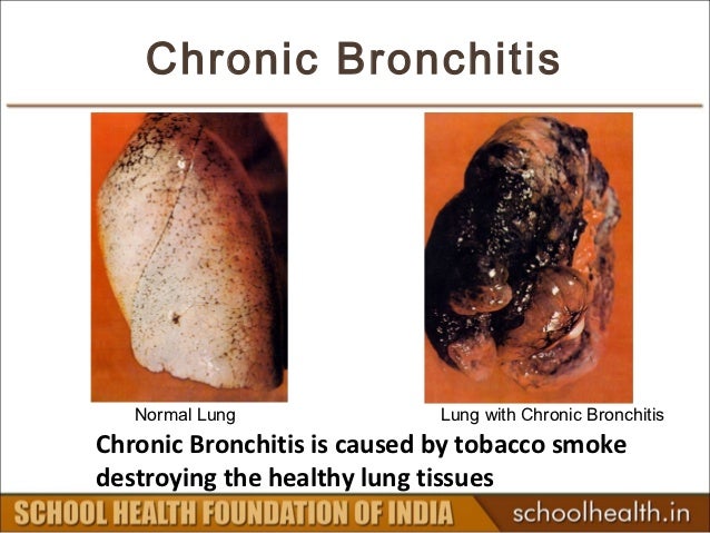 tobacco