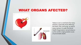 WHAT ORGANS AFECTED?
Tobacco use is a risk factor for many
diseases, especially those affecting
the heart, liver, and lungs, as well as
many cancers. In 2008, theWorld
Health Organization named tobacco
as the world's single greatest cause
of preventable death.
 