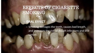 EFFECTS OF CIGARETTE
SMOKING
– ORAL EFFECT
– Smoking damages the teeth, causes bad breath,
and increases the risk of mouth infections and oral
cancer.
 