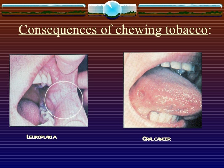 smokeless tobacco essay Chewing or dipping: these terms are familiar to the millions of teens who use smokeless tobacco if you're ready to quit or you want to learn more about smokeless tobacco, read this article. smokeless tobacco essay Chewing or dipping: these terms are familiar to the millions of teens who use smokeless tobacco if you're ready to quit or you want to learn more about smokeless tobacco, read this article.