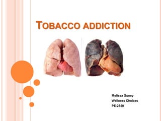 Tobacco addiction Melissa Guney Wellness Choices PE-2850 