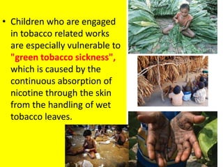 • Children who are engaged
in tobacco related works
are especially vulnerable to
"green tobacco sickness",
which is caused by the
continuous absorption of
nicotine through the skin
from the handling of wet
tobacco leaves.
15
 