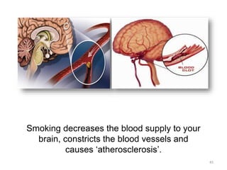 Smoking decreases the blood supply to your
brain, constricts the blood vessels and
causes ‘atherosclerosis’.
45
 