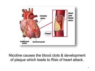 Nicotine causes the blood clots & development
of plaque which leads to Risk of heart attack.
49
 