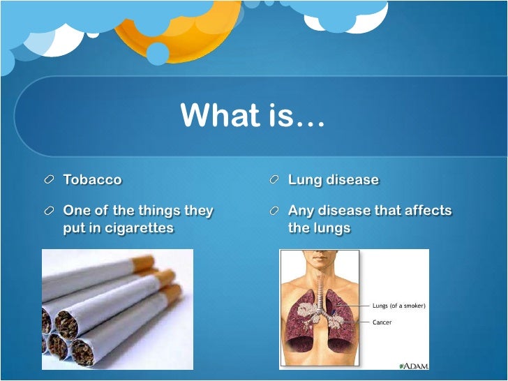 Tobacco and lung disease