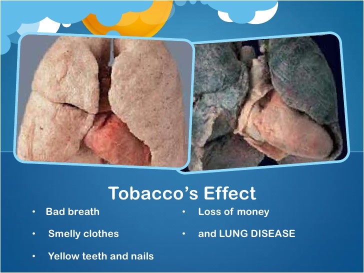 Tobacco and lung disease