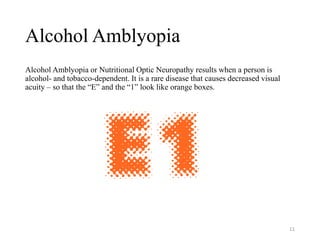 Alcohol Amblyopia
Alcohol Amblyopia or Nutritional Optic Neuropathy results when a person is
alcohol- and tobacco-dependent. It is a rare disease that causes decreased visual
acuity – so that the “E” and the “1” look like orange boxes.
11
 