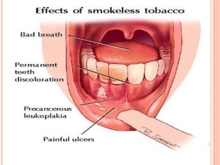 does dan rather chew tobacco Dan was enjoying some smokeless tobacco, aka chewing tobacco, dip (snuff),  back in the old days!  