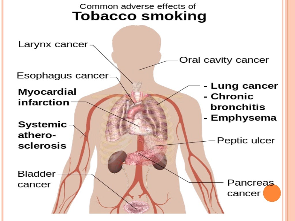 Harmful Health Effects of Tobacco consumption