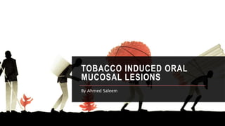 TOBACCO INDUCED ORAL
MUCOSAL LESIONS
By Ahmed Saleem
 