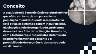 A esquizofrenia é um distúrbio cerebral crônico
que afeta em torno de um por cento da
população mundial. Quando a esquizofrenia
está ativa, os sintomas podem incluir delírios,
alucinações, fala desorganizada, problemas
de raciocínio e falta de motivação. No entanto,
com o tratamento, a maioria dos sintomas da
esquizofrenia melhora bastante e a
probabilidade de recorrência dos surtos pode
ser diminuída.
Conceito
 