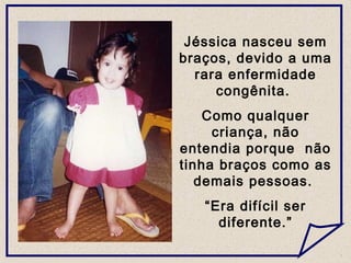 Jéssica nasceu sem
braços, devido a uma
rara enfermidade
congênita.
Como qualquer
criança, não
entendia porque não
tinha braços como as
demais pessoas.
“Era difícil ser
diferente.”
 