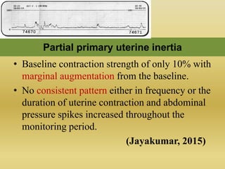 Tocodynamometer Variations Tocodynamometer, cardiotocogram | PPTX