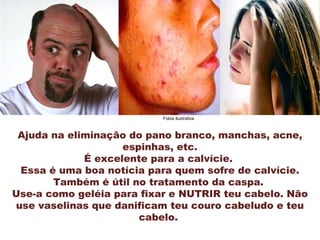 Ajuda na eliminação do pano branco, manchas, acne,
espinhas, etc.
É excelente para a calvície.
Essa é uma boa notícia para quem sofre de calvície.
Também é útil no tratamento da caspa.
Use-a como geléia para fixar e NUTRIR teu cabelo. Não
use vaselinas que danificam teu couro cabeludo e teu
cabelo.
Fotos ilustrativa
 