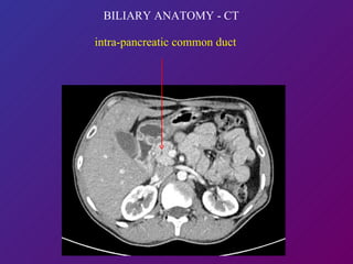 BILIARY ANATOMY - CT intra-pancreatic common duct  