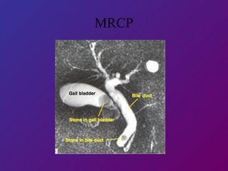MRCP 