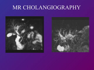 MR CHOLANGIOGRAPHY   