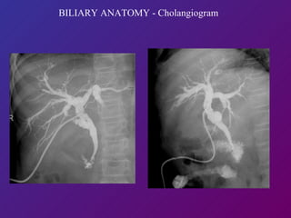 BILIARY ANATOMY - Cholangiogram 