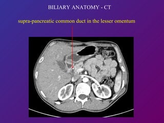 supra-pancreatic common duct in the lesser omentum BILIARY ANATOMY - CT 