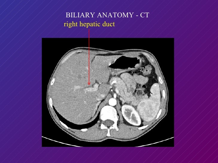 Imaging of Bile Duct Columbia Asia