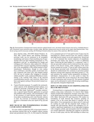 Interproximal reduction using Enamel reduction techniques | PDF