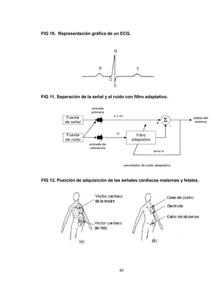 FIG 10. Representación gráfica de un ECG.




FIG 11. Separación de la señal y el ruido con filtro adaptativo.




FIG 12. Posición de adquisición de las señales cardíacas maternas y fetales.




                                       40
 