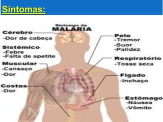Sintomas:
 
