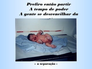 Prefiro então partir
A tempo de poder
A gente se desvencilhar da
gente
• a separação •
 