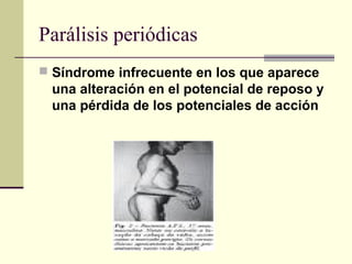 Parálisis periódicas
 Síndrome infrecuente en los que aparece
una alteración en el potencial de reposo y
una pérdida de los potenciales de acción
 