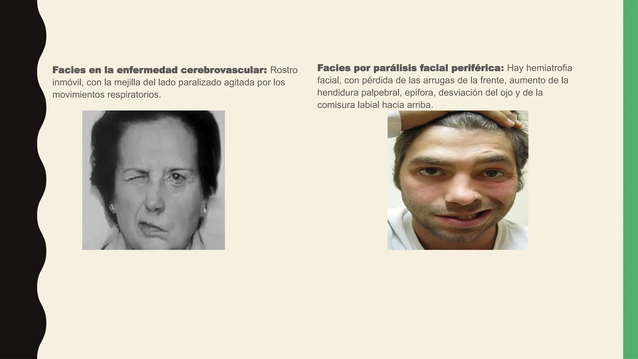 Todos los tipos de Facies y sus patologías | PPT