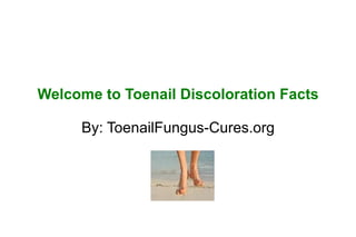 Welcome to Toenail Discoloration Facts

     By: ToenailFungus-Cures.org
 