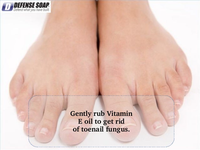 Fungus infections and vitamins